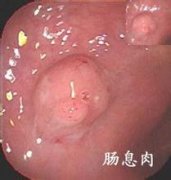 ��ɳ�᳦Ϣ�����ƺ�ҽԺ?