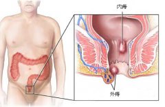 ���̸߷�ԭ������Щ?