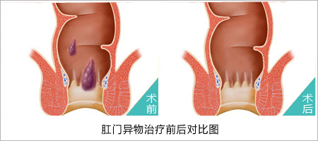 17-140323094U6432.jpg