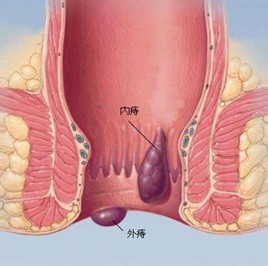 17-140H30S553Q6.jpg