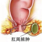 ��ɳ����ŧ�׻������棿